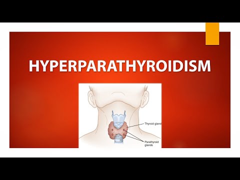 Hyperparathyroidism - Definition, Types, Clinical Features and Treatment