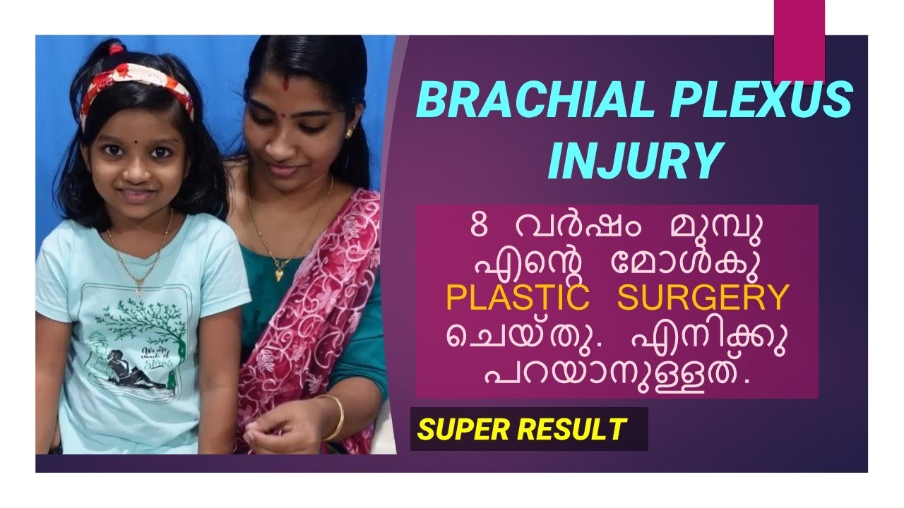 Nerve Transfer Testimonial