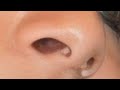 Actress Kalyani Priyadarshan Nose And Lips Closeup Ultra Zoom