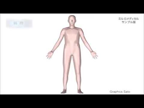 静脈瘤破裂の症状と原因。肝硬変が影響？どんな治療法？ | イケてる男子のブレインミルク
