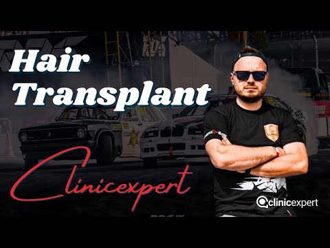 Logo of Nikita Macsakoff Picks Clinic Expert for Perfect Hair Transplant