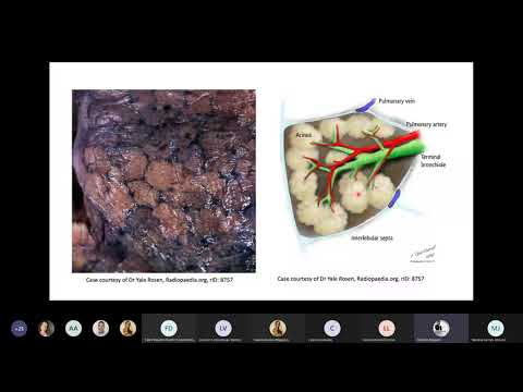 Tomografia Computadorizada do tórax: conceitos básicos e lesões fundamentais