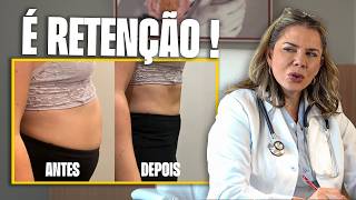Barriga inchada, Retenção de Líquido : Pode ser Estradiol desregulado !