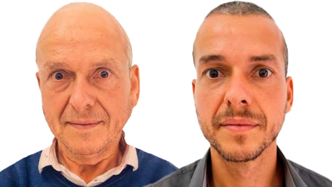 DIETA DA IMORTALIDADE! Como viver até os 100 ANOS? ZONAS AZUIS Documentário Netflix