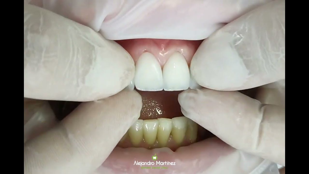 Alejandro Martinez-25