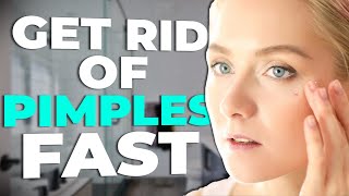 Top 3 Ways To Get Rid of a Pimples Or Whiteheads On Your Face Fast | Acne Treatment