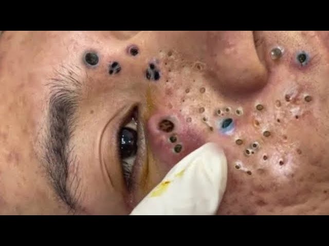 𝑺𝒐𝒐𝒕𝒉𝒊𝒏𝒈 𝑭𝒂𝒄𝒊𝒂𝒍 𝑻𝒓𝒆𝒂𝒕𝒎𝒆𝒏𝒕 𝑭𝒐𝒓 𝑺𝒕𝒓𝒆𝒔𝒔 𝑹𝒆𝒍𝒊𝒆𝒇 𝒂𝒕 𝑳𝒖𝒙𝒖𝒓𝒚 𝑺𝒑𝒂 𝑨𝒄𝒉𝒊𝒆𝒗𝒆 𝑰𝒏𝒏𝒆𝒓 𝑷𝒆𝒂𝒄𝒆 #500382