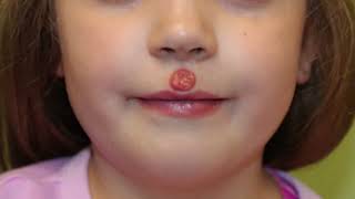 Plastic Surgery for Lips ঠোঁটের বিভিন্ন ধরণের প্লাস্টিক সার্জারি কীভাবে করা হয়