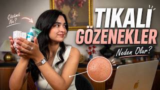 Tıkalı Gözenekler İçin Ne Kullanmalısınız? Dermatolog Anlatıyor