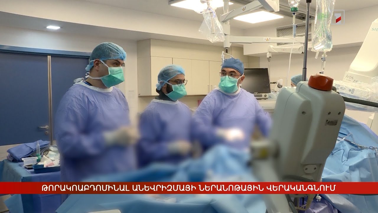 Թորակոաբդոմինալ անևրիզմայի ներանոթային վերականգնում. եզակի վիրահատություն