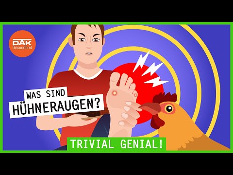 Was genau sind Hühneraugen? | #trivialgenial | DAK-Gesundheit