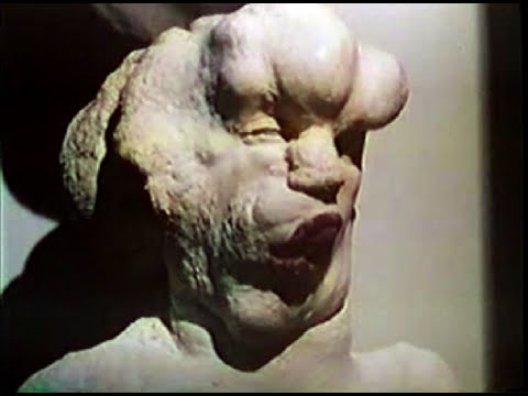 6-05A In Search Of... The Elephant Man (Part 1 of 3)