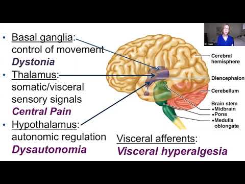 Pediatric Grand Rounds: Chronic Neuro-Pain in Children with Severe Neurological Impairments