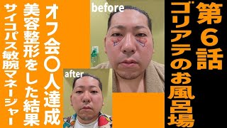 #６ ゴリアテ、人生初美容整形