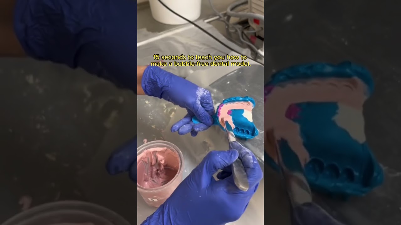 15 seconds to teach you how to make a bubble-free dental model. #dentallab #dentist #dental