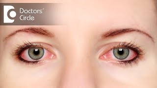 How to get rid of foreign body sensation in one eye? - Dr. Elankumaran P
