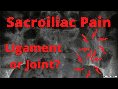 Sacroiliac Joint vs Sacroiliac Ligament | Which Is The Source Of Pain?