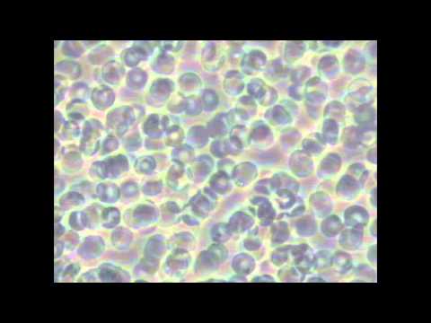 CCC0150082 @2015.09.24 before/after photos