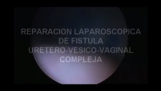 Dr. Javier Machuca - Reparación laparoscopica de fistula. Uretero-Vesico-Vaginal Compleja