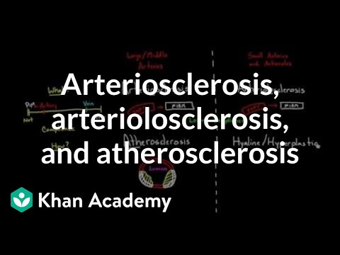 Arteriosclerosis, arteriolosclerosis, and atherosclerosis | Health & Medicine | Khan Academy
