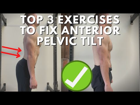 Conor Harris — Top 3 Exercises To Fix Anterior Pelvic Tilt