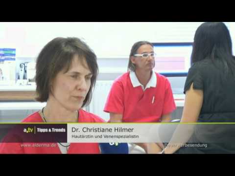 Krampfadern, Besenreiser Venenleiden - Alderma.de Praxisklinik