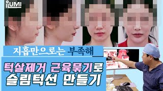 #이중턱지방흡입 근육묶기????수술多경험,노하우가 중요하다!? #아이루미성형외과 #顎下脂肪吸引 筋肉縛り 手術経験多い！ ノーハウが大事！？ #アイルミ整形外科
