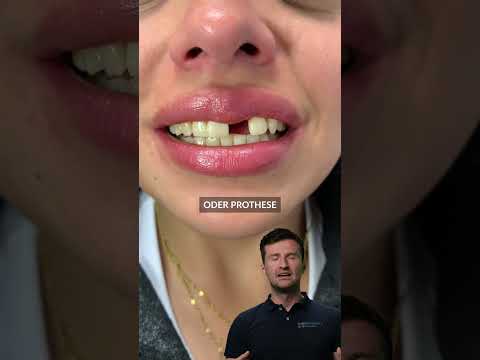 Lost a front tooth. Quick temporary solution #shorts