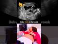 Funny Baby Farts in the Womb😂 Mom Surprised 😯 Just for Fun😂💯 Babies Don't Fart