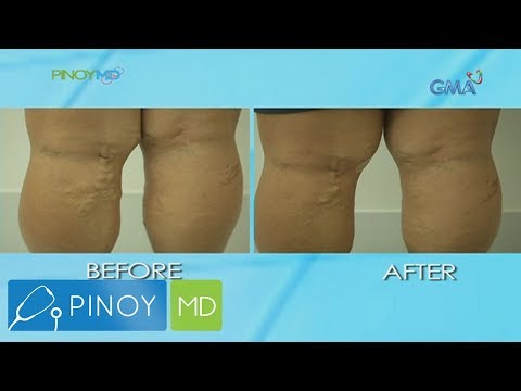 Isang sistema ng pagsasanay para sa pagbaba ng timbang para sa mga kababaihan Ay posible na mawalan ng timbang dahil sa taba nasusunog na cocktail