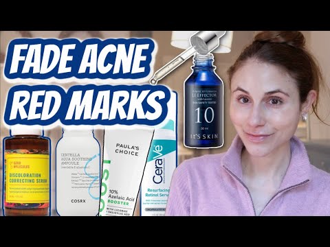 Best products to FADE POST ACNE RED MARKS (PIE)| Dr Dray