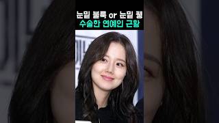 [50만] 안 받는 의사들이 없다는 이 시술?!