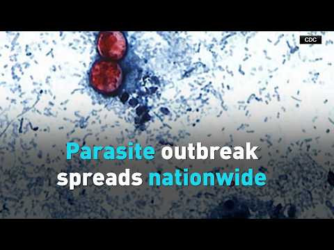 Parasite outbreak spreads nationwide