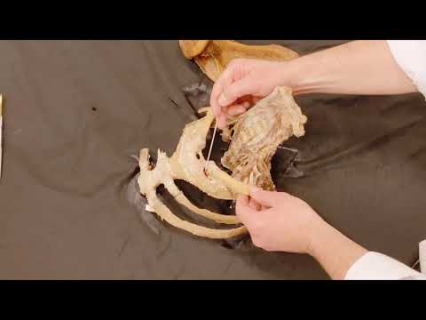 Der Schlüssel zur oberen Extremität: Artt. sterno- et acromioclavicularis kurz und knackig!