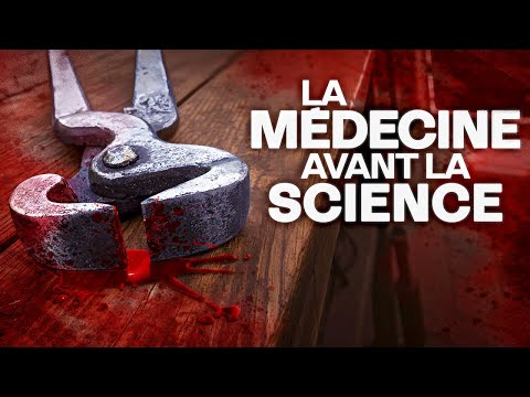 Une médecine douteuse mais efficace au Haut Moyen Âge ?