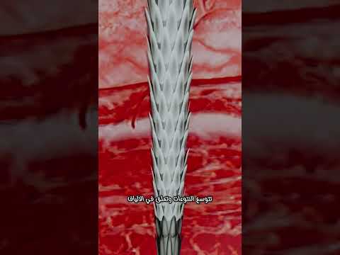 "سر شوك القنفذ الذي ألهم العلماء لاختراع إبر طبية مذهلة!"