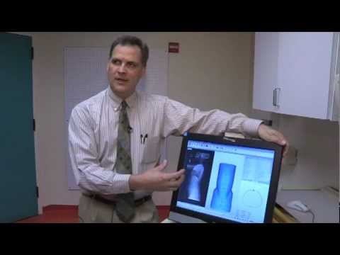 CAD/CAM System for Prosthetics and Orthotics at SRH