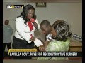 Circumcision Gone Bad Bayelsa Government Pays For Reconstructive Surgery