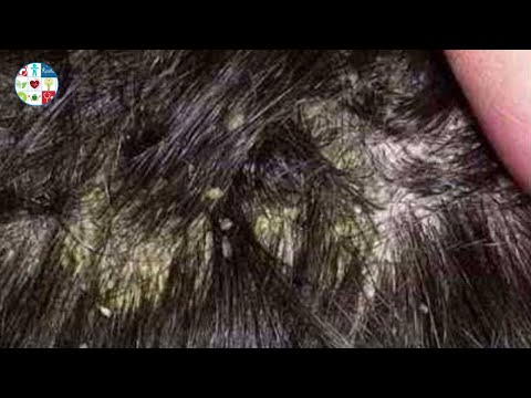 download lagu mp3 mp4 Kotobe, download lagu Kotobe gratis, unduh video klip Kotobe