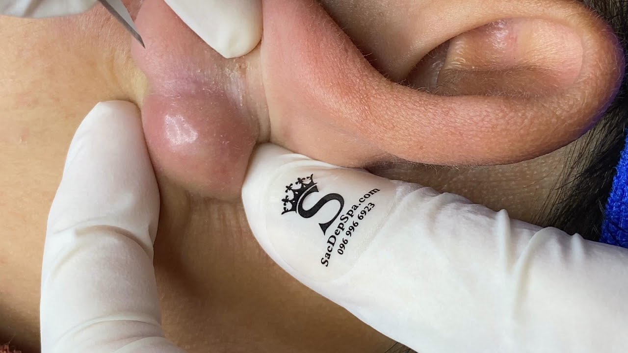 Watch Now Satisfying Relaxing with Sac Dep Spa Video (#296) #SacDepSpa Satisfying Relaxing with Sac Dep Spa Video (#296) #SacDepSpa