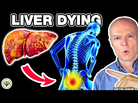 10 Weird Signs You Already Have LIVER DAMAGE