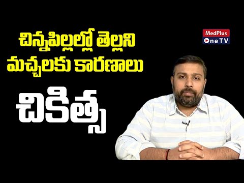 Main Causes of Milia in Newborn Babies Dr.Sandeep Reddy