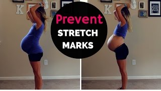 HOW TO PREVENT STRETCH MARKS DURING PREGNANCY! 2nd Baby, 36 Weeks!