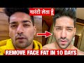 How To Remove Face Fat In 10 Days | Lose DOUBLE CHIN & CHUBBY CHEEKS Fast