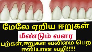 ஈறுகள் மேலே ஏறி அசிங்கமாக உள்ளதா! Receding gums home remedy