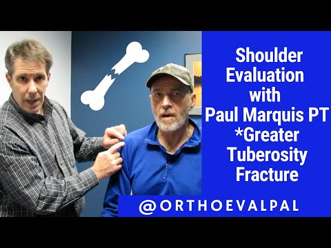 Shoulder Apprehension Test and Relocation Test