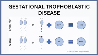 Gestational Trophoblastic Disease (Molar Pregnancy) Explained