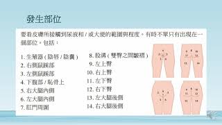 [寶寶] 詢問紅臀/紅屁屁的照顧方式？