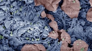 Nanoparticles that speed blood clotting may someda