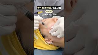 혈액세포 시술 과정 공개!